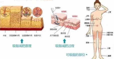 d4图片1.png